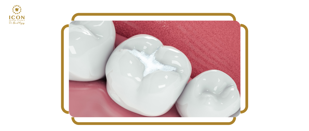 الحشوات التجميلية - عيادة ايكون